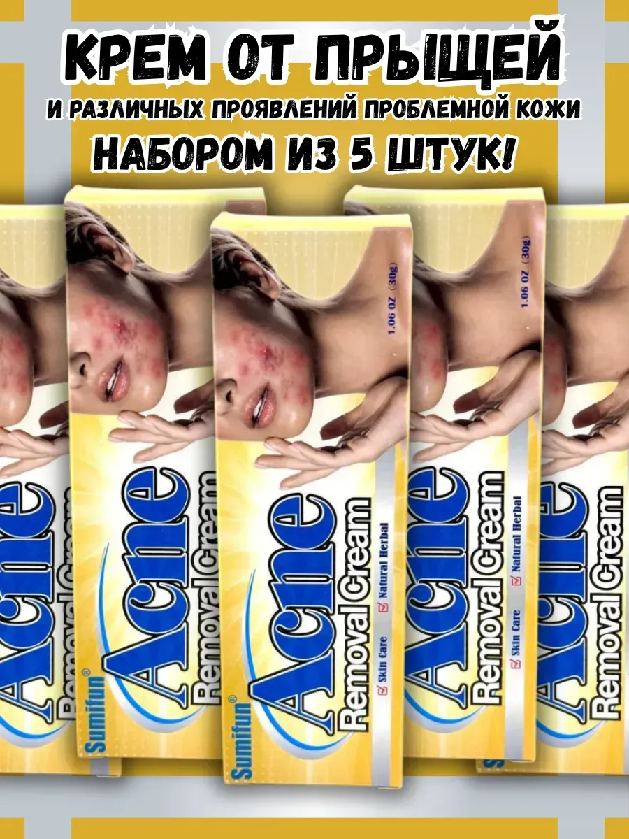 BOSA / Крем от прыщей и акне набором из 5 штук