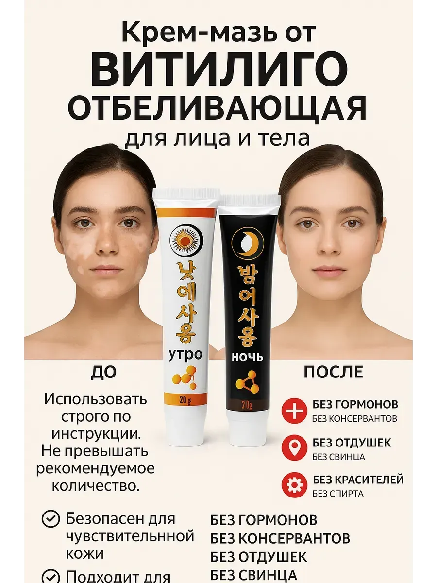 Тисс.pam / Мазь от витилиго китай от пигментных пятен на лице