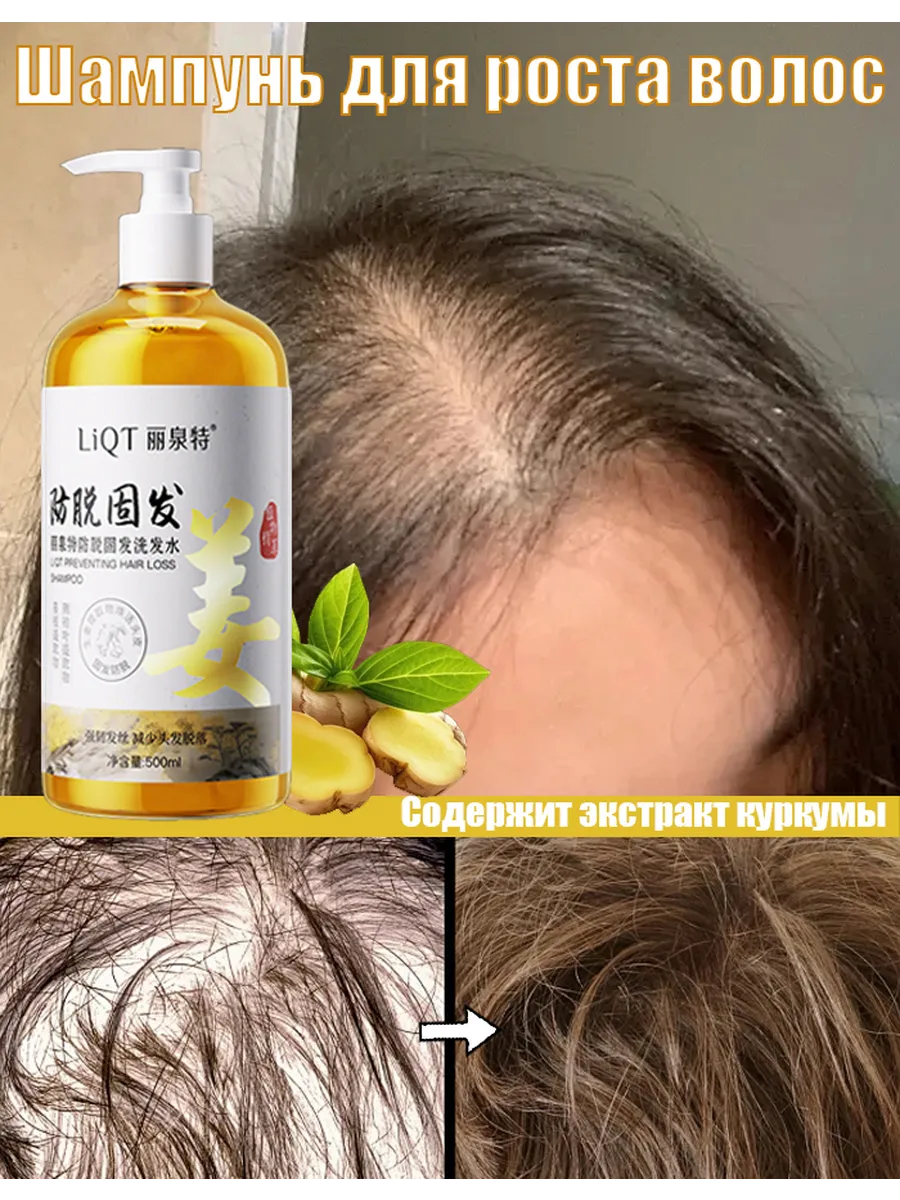 Шампунь против выпадения волос 500 ml