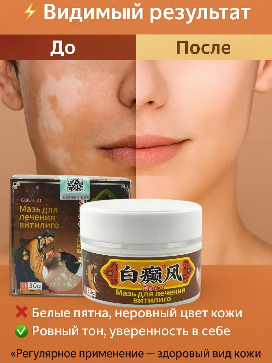 AG777 / Мазь для лечения витилиго GUCALLO 30г натуральная