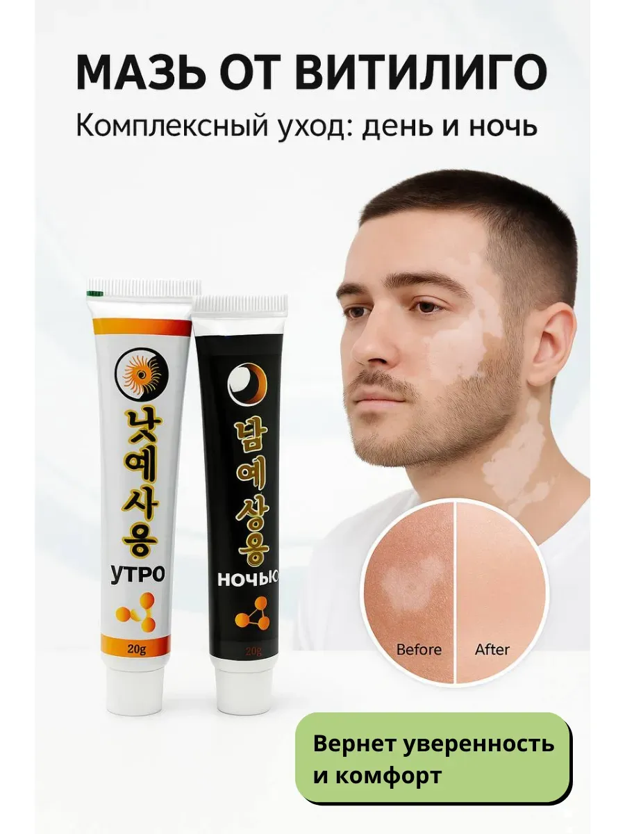 ОКЕН / Мазь от витилиго дневная и ночная формула